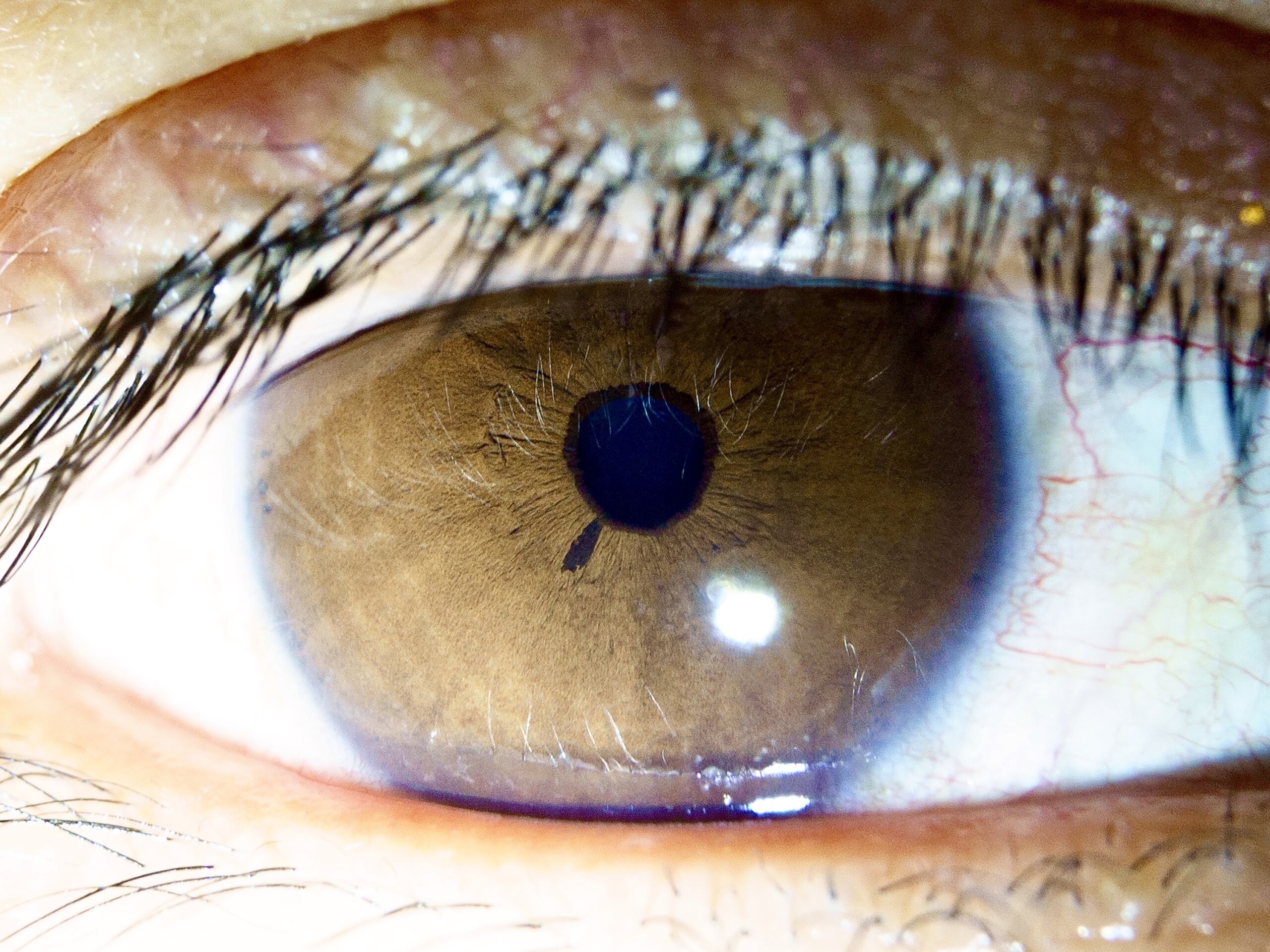 23rd - 2's eye